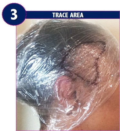 amidbeauty.com, head template, head mould, mold, wig making, wigmaker, custom head, trace area, outline, hairpiece, toupee